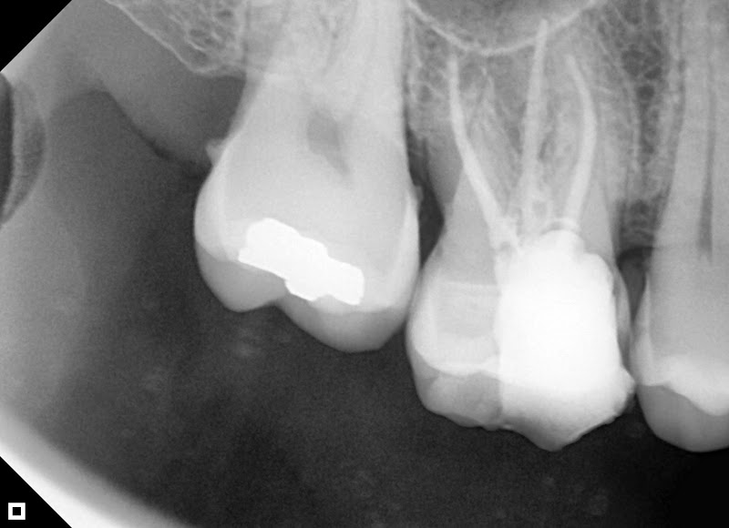 Foto 3 de Dr Gustavo Tavares - Urgencia Odontologica em Sobral