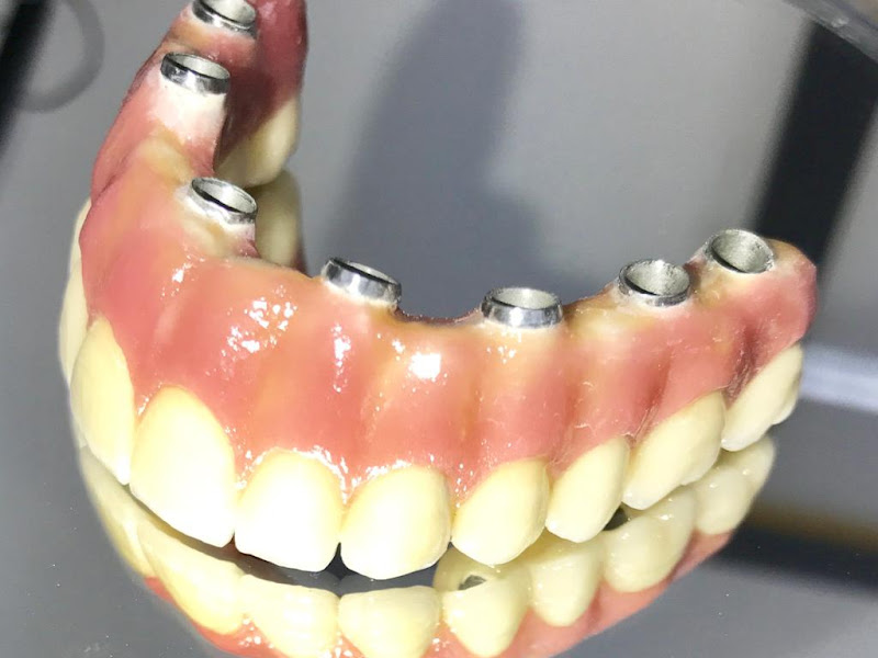 Foto 3 de Dr.Guto Fidalgo (Cirurgia Bucomaxilofacial e Implantodontia)