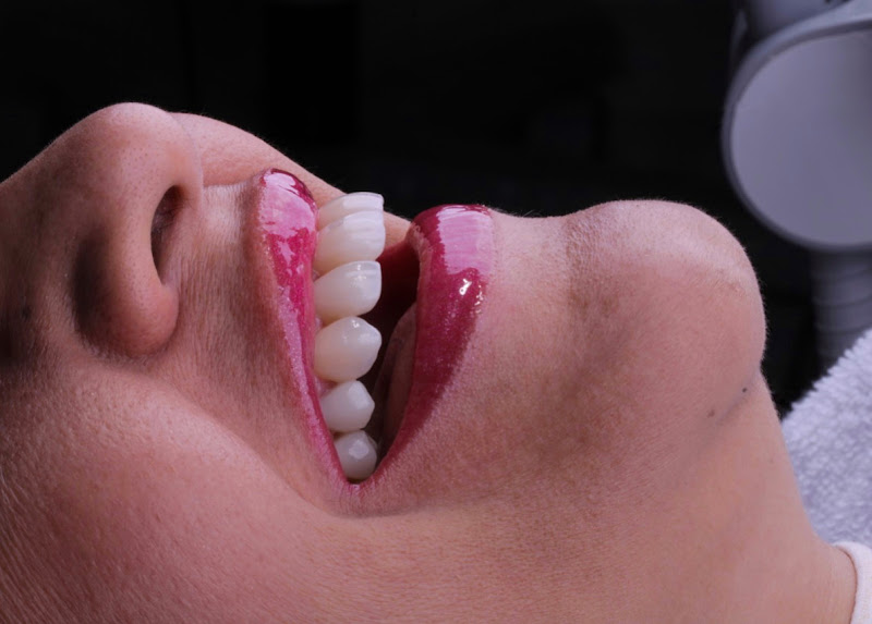 Foto 3 de Dr. Hamon Lustosa