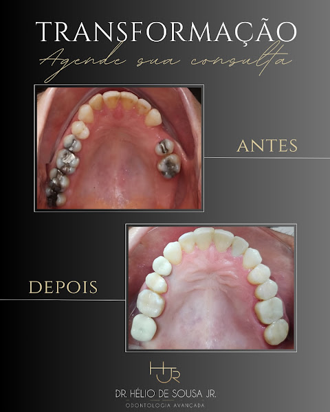 Foto 3 de Dr. Helio de Sousa Jr - Invisalign | Implante | Ortodontista | Dentista