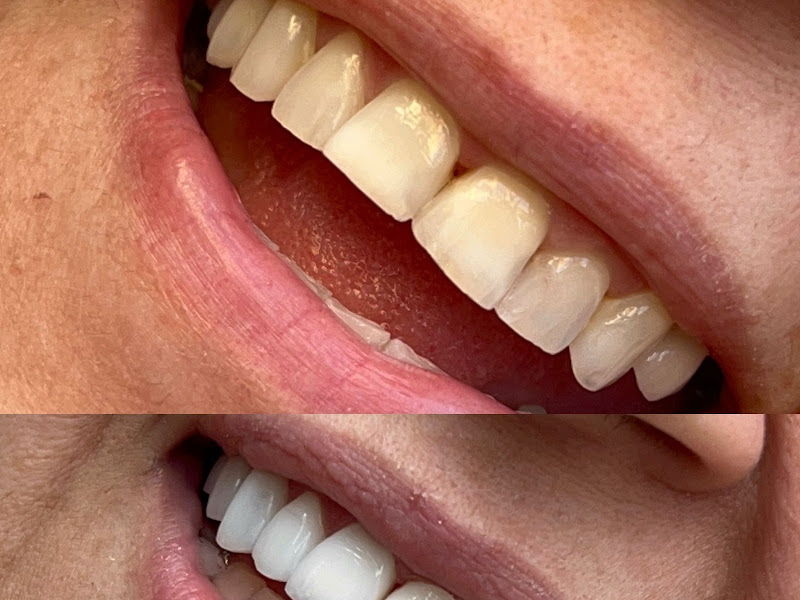 Foto 4 de Dr Hélio Ping | Odontologia Digital