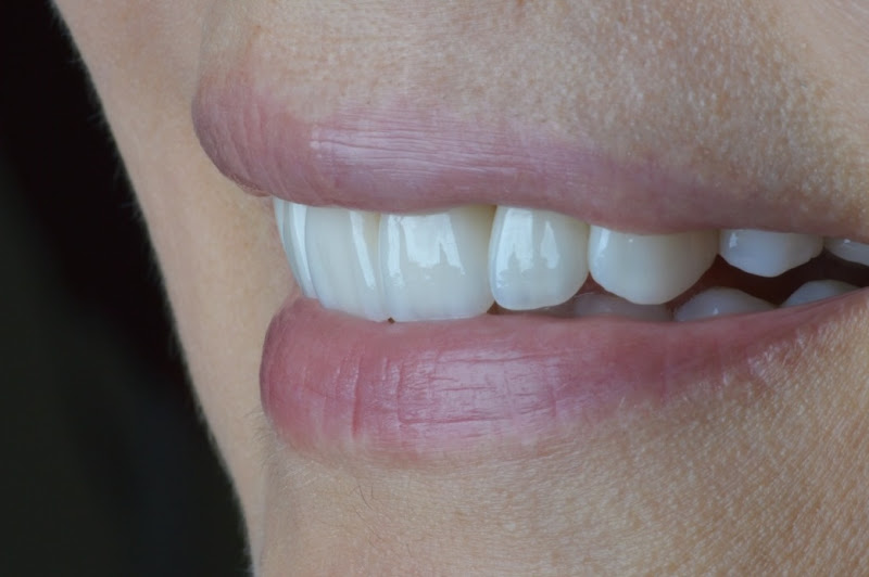 Foto 3 de Dr Henrique Brito I Odontologia Estética no Juvevê