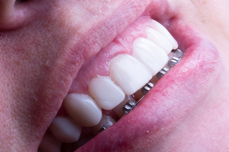 Foto 2 de Dr Henrique Macambira Dentista Teresina
