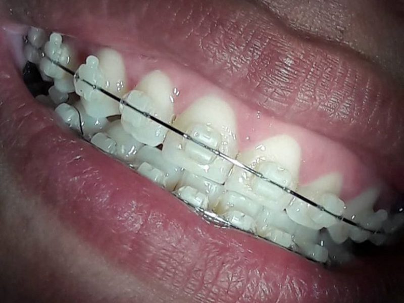 Foto 7 de DR° Henrique Vieira Bacelar e DR° Antônio Fernandes Filho