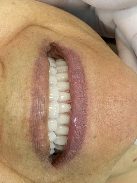 Foto 3 de Dr. Hudson Pierre - Implantodontia, Cirurgia & Reabilitação Oral - Consultorio odontologico