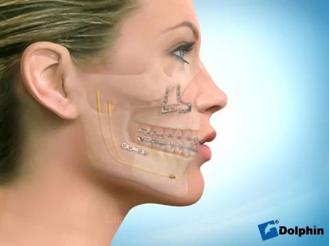 Foto 3 de Dr Igor Damasceno-ProFace Cirurgia Buco Maxilo Facial