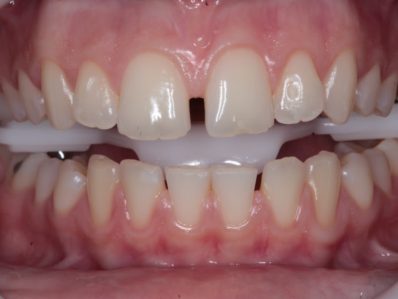 Foto de Dr. Irwing Corrêa - Especialista em Prótese Dentaria