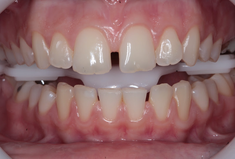 Foto 2 de Dr. Irwing Corrêa - Especialista em Prótese Dentaria