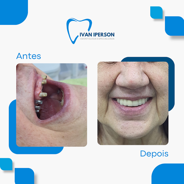 Foto 2 de Dr. Ivan Iperson Odontologia