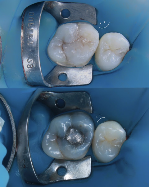 Foto 2 de Dr. Jackson Moura - Odontologia Estética - Facetas - Clareamento - Coroa - Ponte fixa - Lente de contato dental