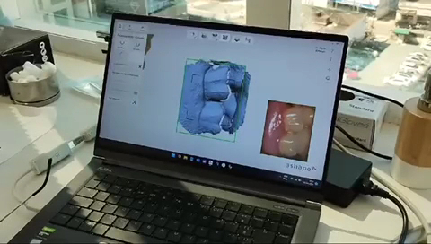 Foto 3 de Dr. Jadson Dos Reis Santos, Dentista Itajaí