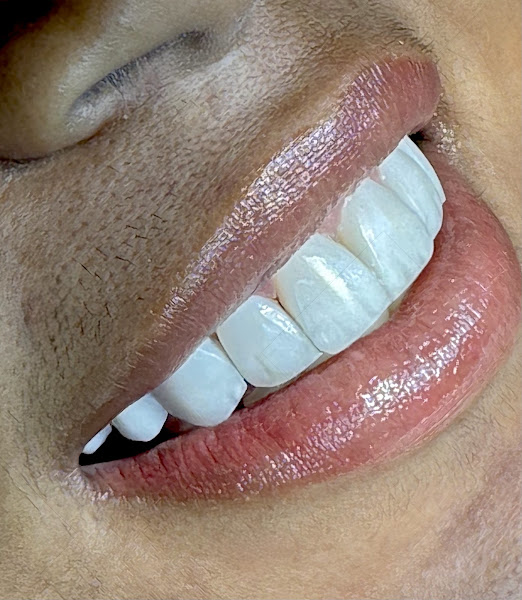 Foto 2 de Dr. Jean Carlos | Dentista em Juazeiro do Norte | Urgência 24h