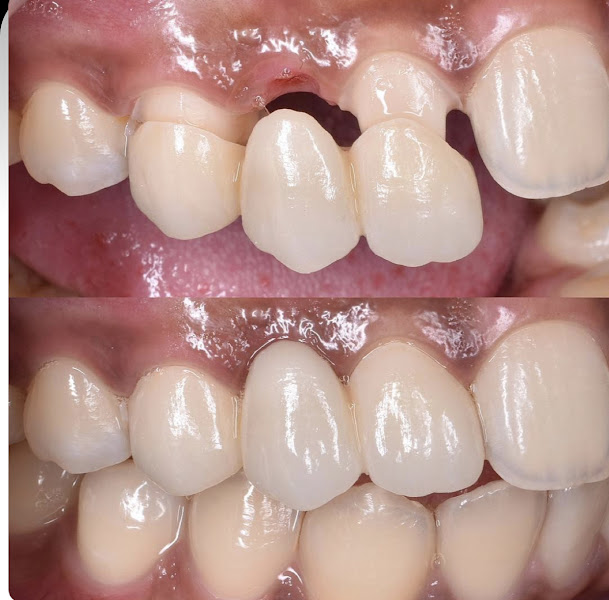 Foto 3 de Dr. Jean Cirurgião-Dentista Especialista em implantes, sedação e siso/ Recreio e Barra Da Tijuca