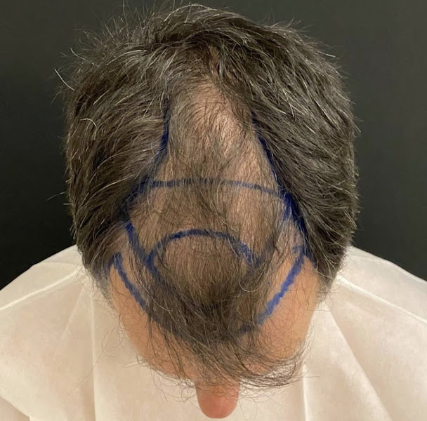 Foto 3 de DR.JEANLEY VIEIRA | DERMATOLOGISTA | SBD