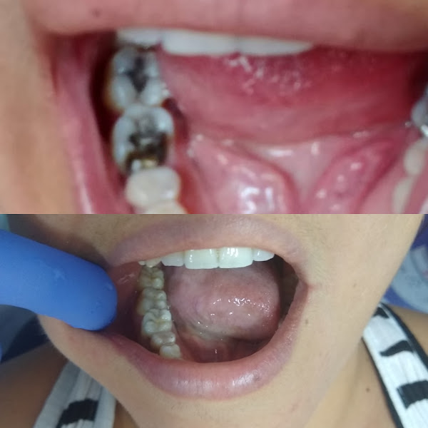 Foto 3 de Dr. Jefferson Lopes | Dentista em Natal - prótese, implante dentário, clareamento dental, facetas. Clínica odontológica.