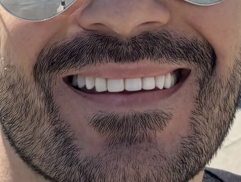 Foto 3 de Dr. Jessé Passos - Implantes Dentários Porto Alegre