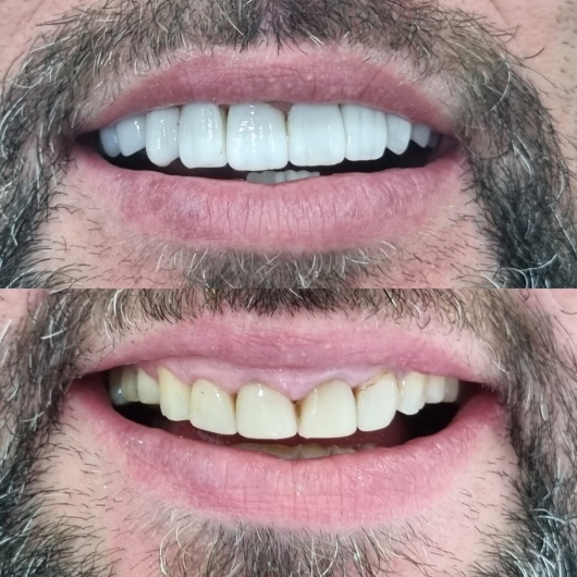 Foto 2 de Dr. João Alberto Delgado Coelho - Implantes dentários