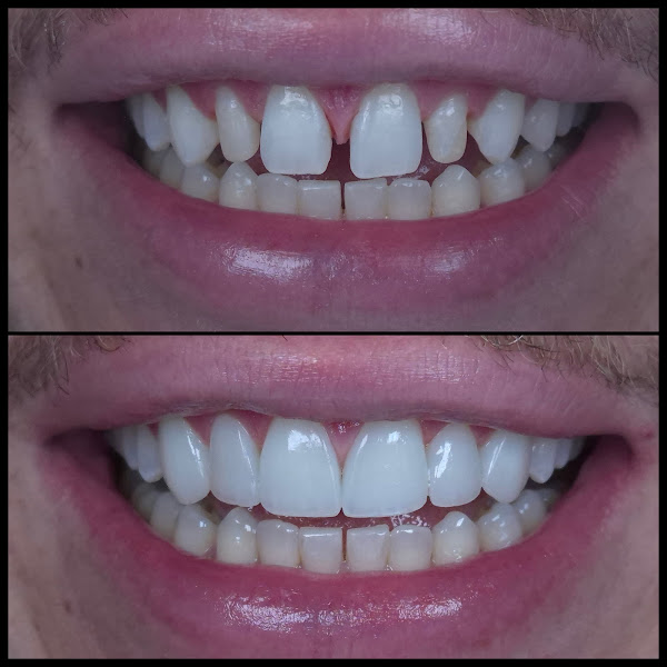 Foto 2 de Dr João Campos - Cirurgião Dentista