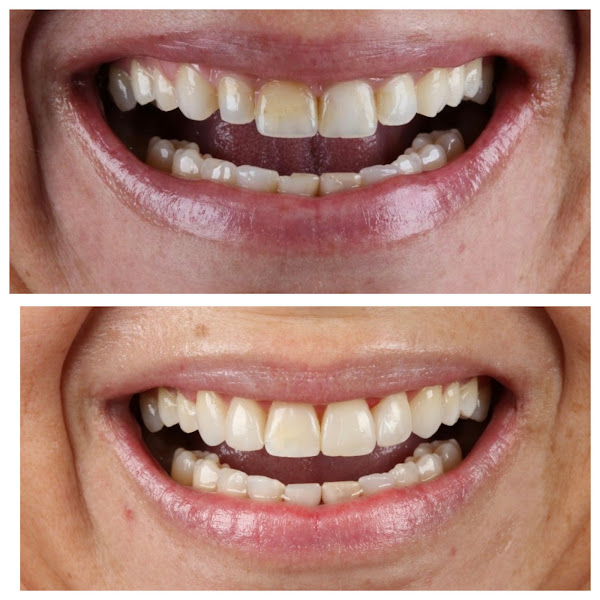Foto 3 de Dr João Campos - Cirurgião Dentista