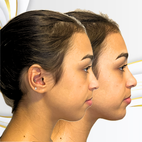 Foto 3 de Dr. João Carneiro - Emagrecimento e Harmonização Corporal