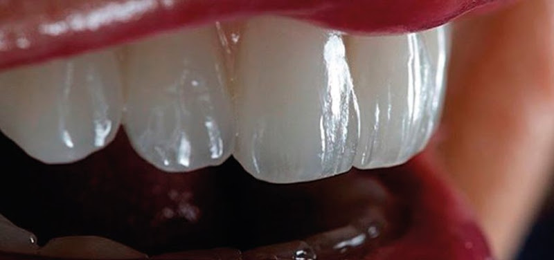 Foto 2 de Dr. João Delavequia