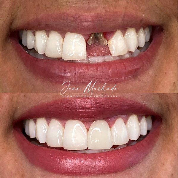 Foto 2 de Dr. João Machado | Dentista