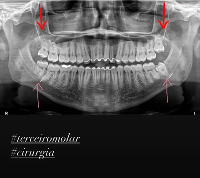 Foto 3 de Dr. João Mascarenhas - Periodontia E Implante