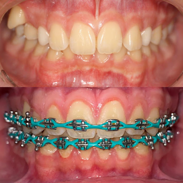 Foto 3 de Dr. João Paulo Piva - Ortodontia em Brusque, Estética