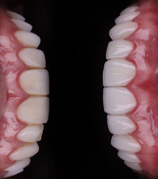 Foto 3 de Dr. João Pedro - Cirurgião Dentista