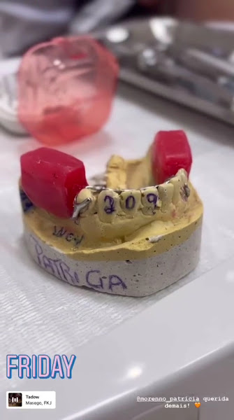 Foto 3 de Dr. João Pedro Dias - Lentes de Porcelana em Goiânia