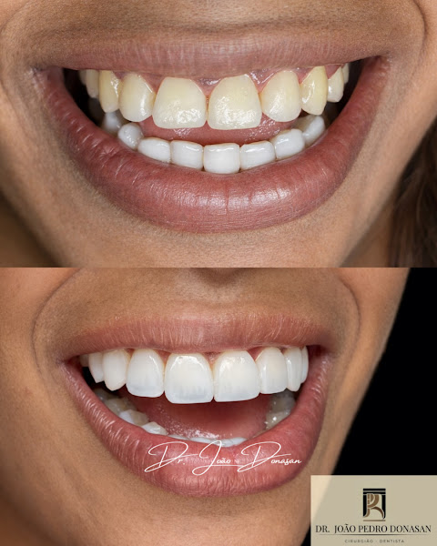 Foto 3 de Dr. João Pedro Donasan | Dentista em Maringá