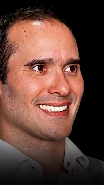 Foto 3 de Dr João Pedro Mazzon, Cirurgião Bucomaxilo em São Paulo, Especialista em Cirurgia Ortognática, Mentoplastia, ATM e DTM