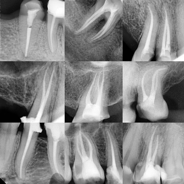 Foto 3 de Dr. João Rios Endodontista Zona Norte