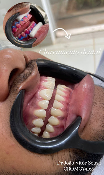 Foto 3 de Dr.João Vitor Sousa