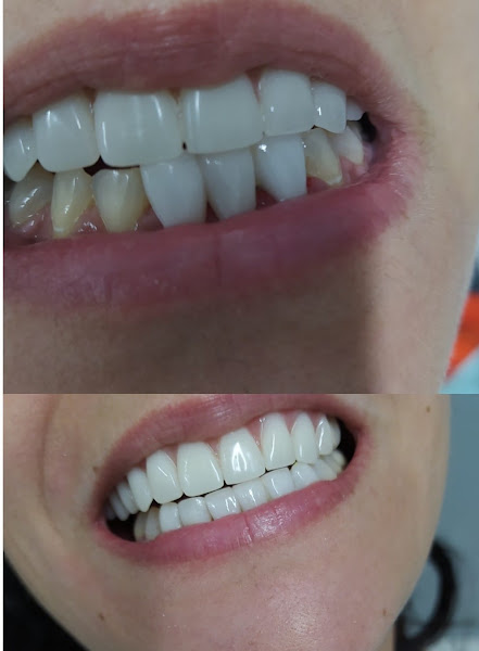 Foto 2 de Dr. Joaquim Marcelino | Implantes e Estética Dental em Santo André
