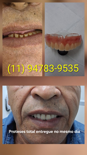 Foto 3 de Dr. Joaquim Marcelino | Implantes e Estética Dental em Santo André