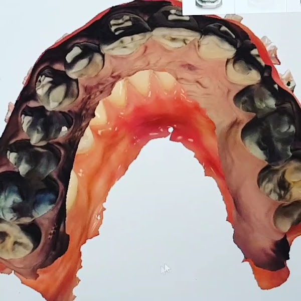 Foto 3 de Dr Joel Pola - Clínica Odontológica - Santo André, São Paulo