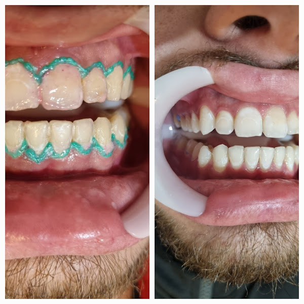 Foto 3 de Dr. Jolai Gazzoni - Dentista em Palhoça