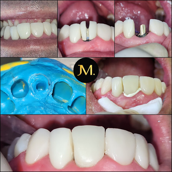 Foto 3 de Dr. Jonas Meireles | Reabilitação Oral
