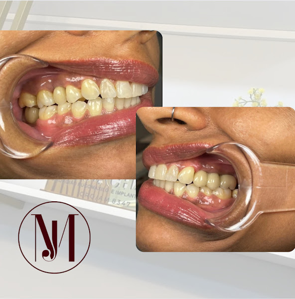 Foto 2 de Dr Jordan machado - Clínica odontológica /Parque 10