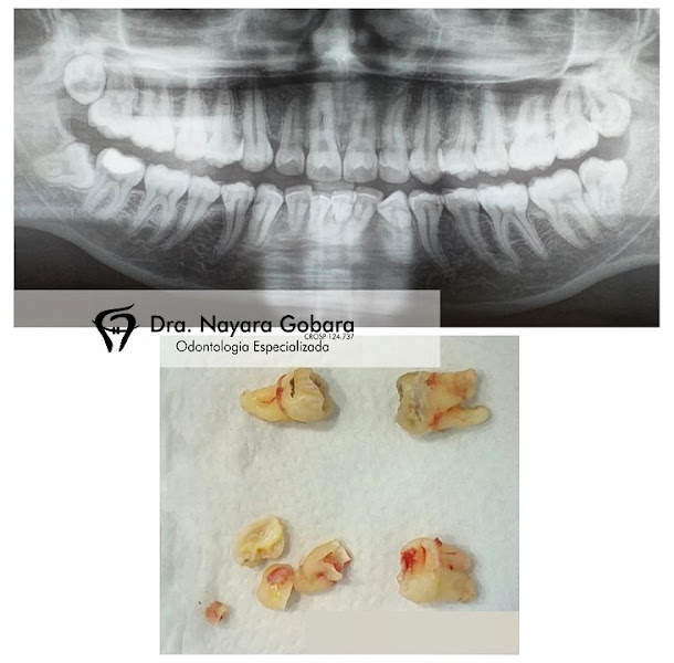 Foto 3 de Dr. Jorge Gobara Dentista