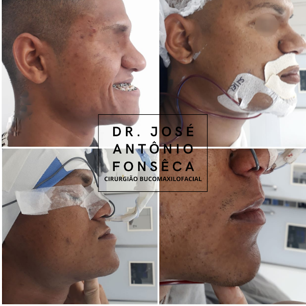 Foto 3 de Dr. José Antonio Fonseca | Cirurgião Buco Maxilo Facial