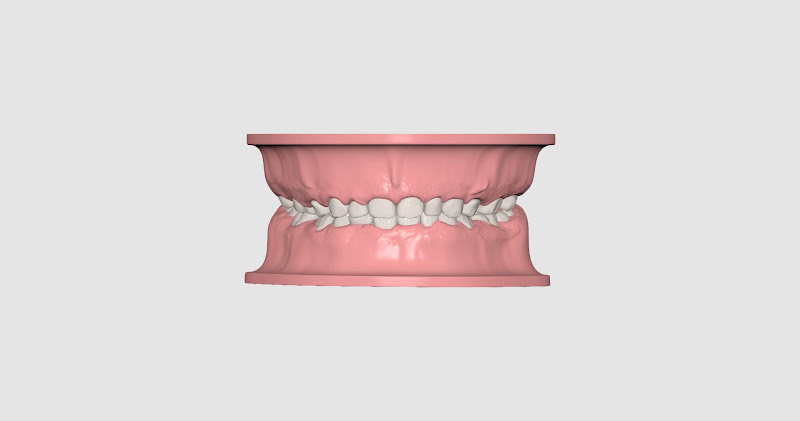 Foto 3 de Dr. José Eduardo Luz Silva | Ortodontista Pediátrico