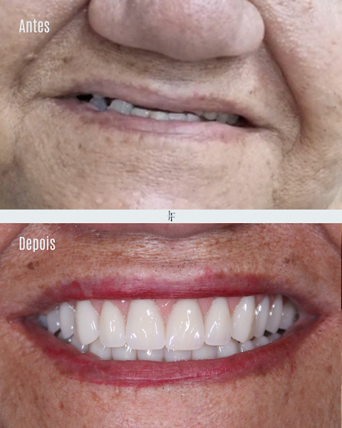 Foto 3 de Dr. José Freitas | Dentista | Pinheiros | Implantes