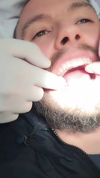 Foto 3 de Dr. José Olympio | Dentista em Jundiaí