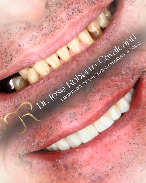 Foto 3 de Dr José Roberto Cavalcanti - ODONTO ADVANCED