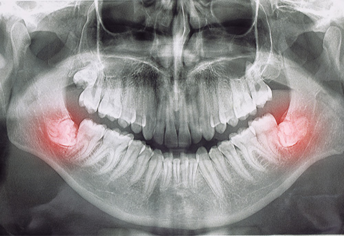 Foto 3 de Dr. Josiclei Castro, Cirurgião Bucomaxilofacial - Linhares, ES