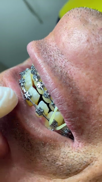 Foto 4 de Dr. Josinaldo Filho - Dentista em João Pessoa (Ortodontista Especialista/Aparelho Dental)