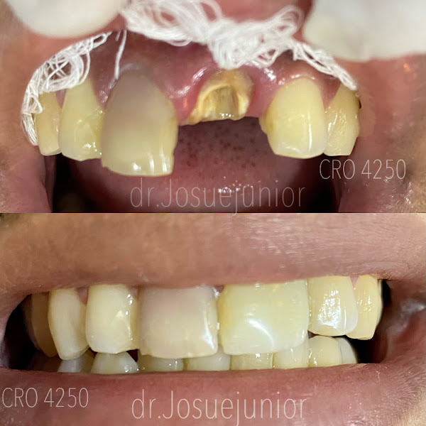 Foto 2 de Dr. Josué Júnior Dentista