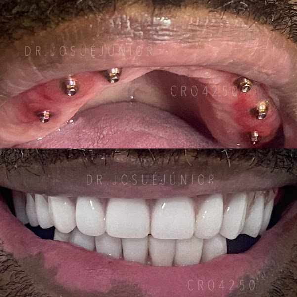 Foto 3 de Dr. Josué Júnior Dentista
